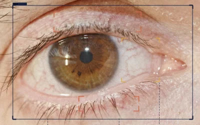 Ontstoken oog: wat te doen?